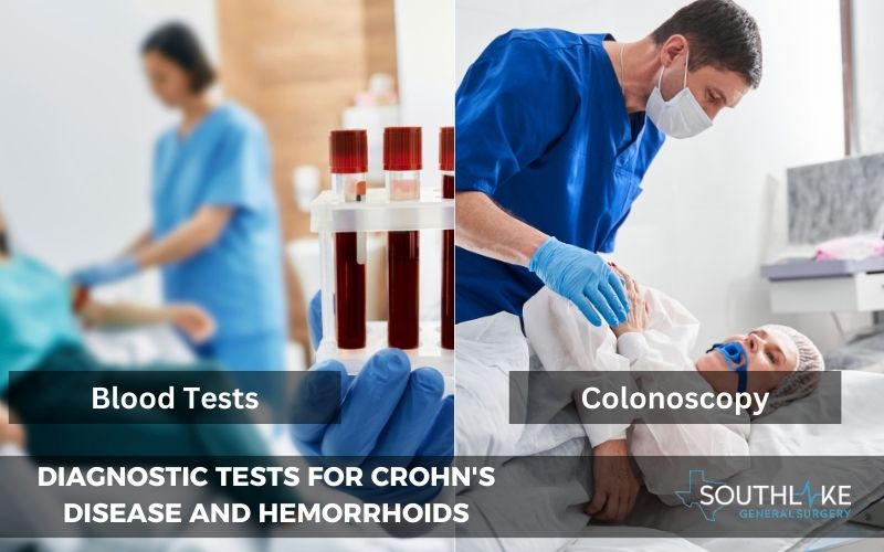 Diagnostic tests for Crohn's disease and hemorrhoids.