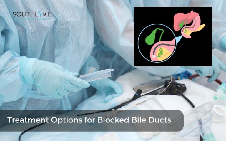 Blocked Bile Duct Symptoms Essential Guide Southlake General Surgery