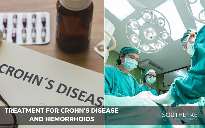 Medication and Surgery for Crohn's Disease and Hemorrhoids.