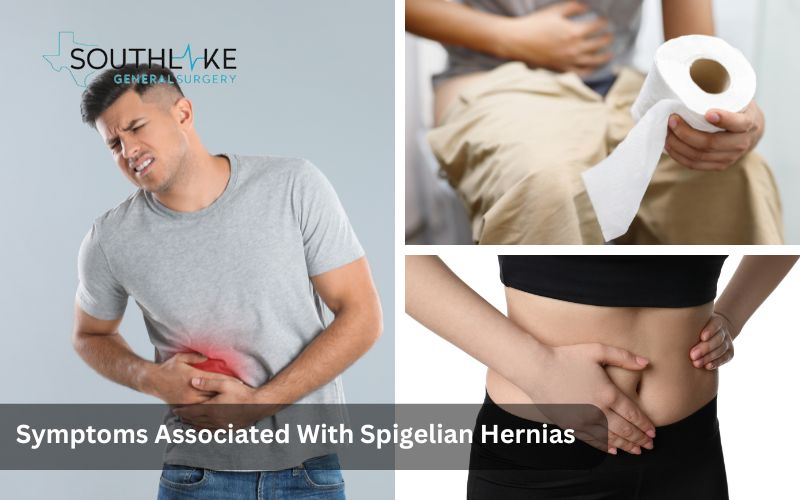 Infographic showing common symptoms of Spigelian hernia including abdominal pain, changes in bowel function, and a soft swelling.