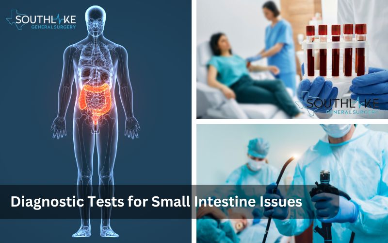 Symptoms and Diagnostic Tests for Small Intestine Issues.