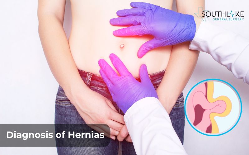 Doctor conducting a physical examination to diagnose a hernia.