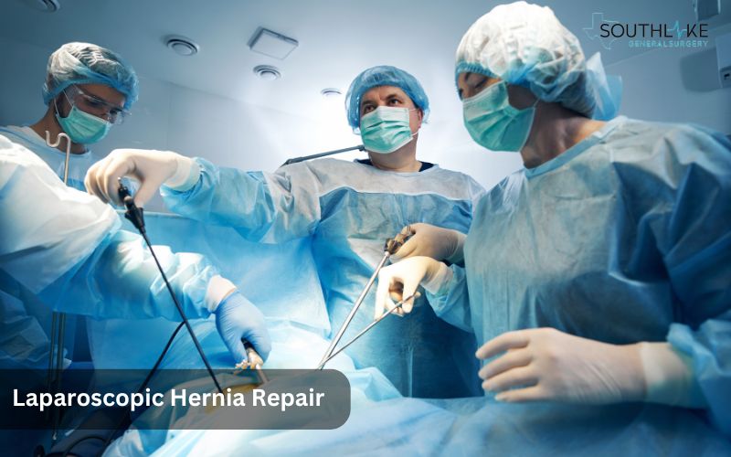 A laparoscopic hernia repair on a patient with a Spigelian hernia.