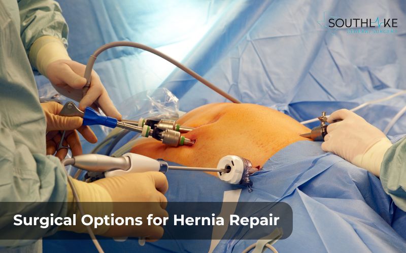 Laparoscopic surgery being performed for hernia repair with surgical instruments and a camera.