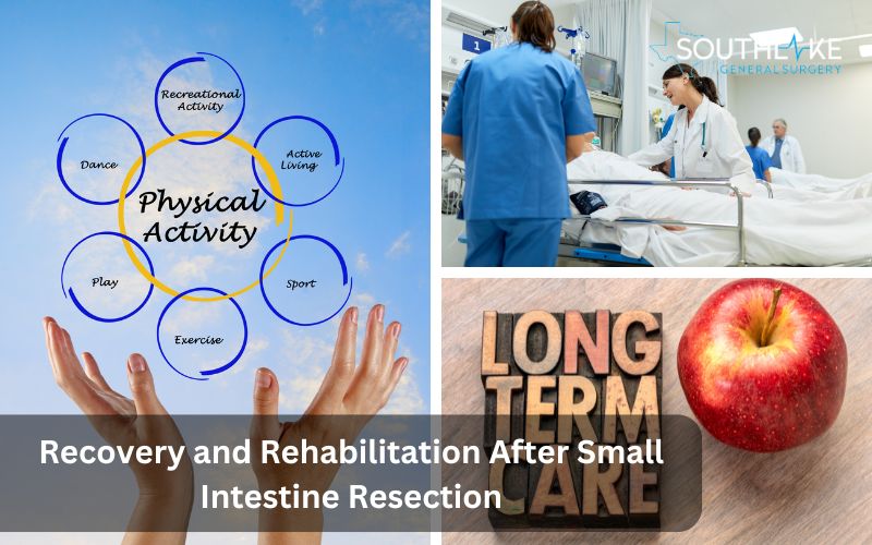 Recovery and Rehabilitation After Small Intestine Resection