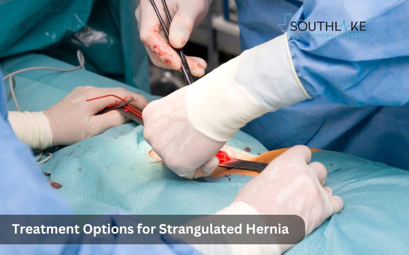 Surgeon performing hernia repair surgery to treat a strangulated hernia.