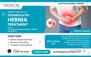 Expert Advice on Strangulated Hernia Treatment