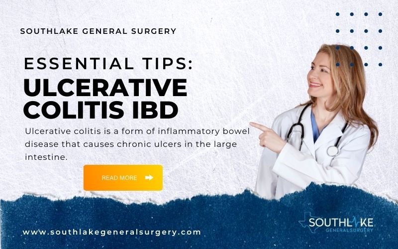 Ulcerative Colitis IBD