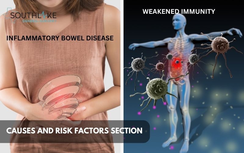 Diagram showing factors contributing to anorectal abscesses.