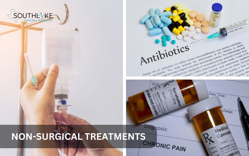 Visual representation of non-surgical treatments for cholecystitis, including antibiotics, intravenous fluids, and pain relief medication.