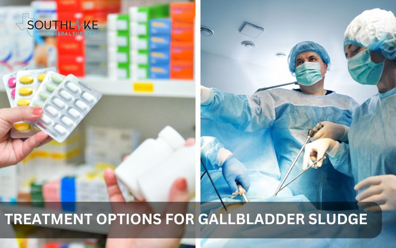 Comparison of non-surgical treatments and surgical options for managing gallbladder sludge.