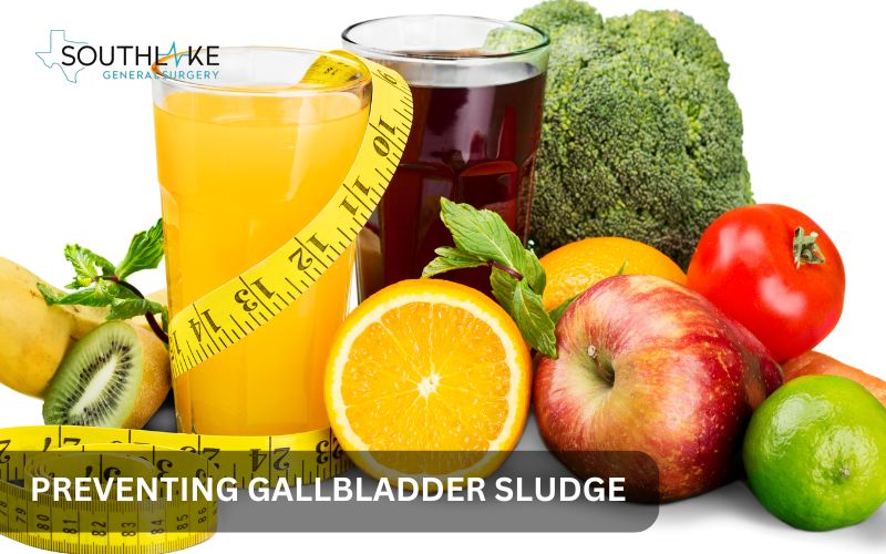 Healthy diet options to prevent gallbladder sludge, including olive oil, whole grains, and vegetables.