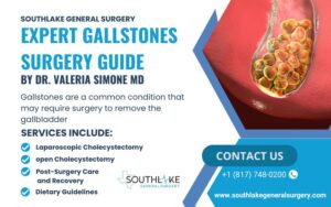 Detailed anatomy of the gallbladder showing cholesterol and pigment gallstones, highlighting the causes of gallstone formation.