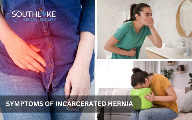 Illustration of incarcerated hernia symptoms showing severe pain in the groin area, nausea, and vomiting.