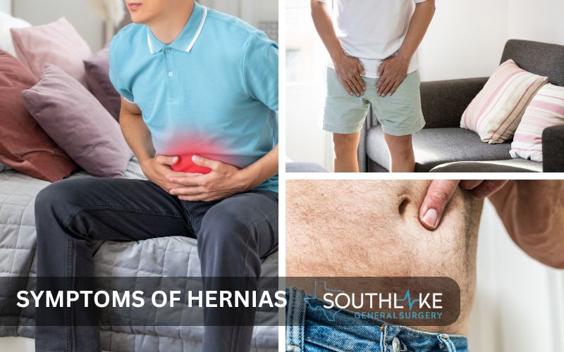 Illustration depicting common symptoms of hernias such as abdominal pain, bulging, and discomfort in the groin area.