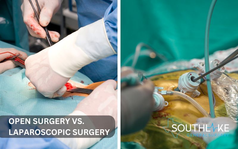 Comparison between open and laparoscopic hernia surgery, showing incisions and tools used in both approaches.