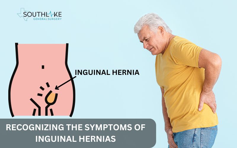 Illustration of a male patient with a visible bulge in the groin area, representing a typical symptom of an inguinal hernia.