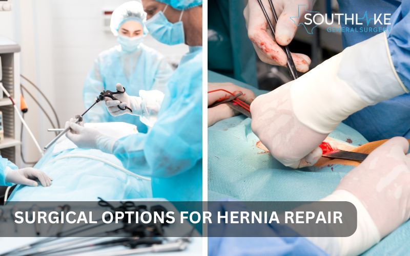 Image comparing laparoscopic surgery and open surgery for hernia repair with a focus on minimally invasive techniques.