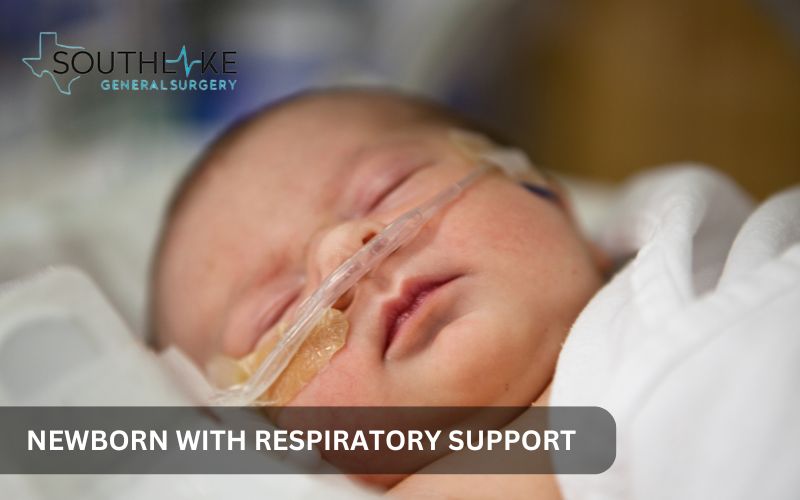 Newborn receiving respiratory support, highlighting the severity of breathing complications associated with congenital diaphragmatic hernia.