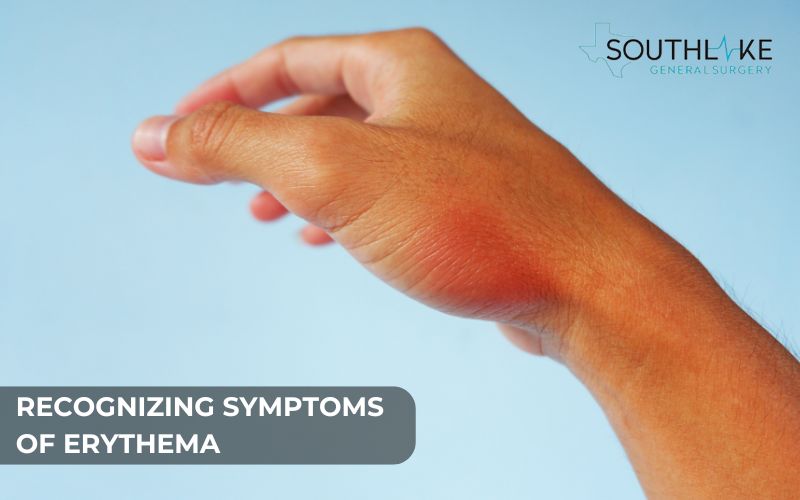 Erythema symptoms: Red spots, patches, and swelling on the skin.