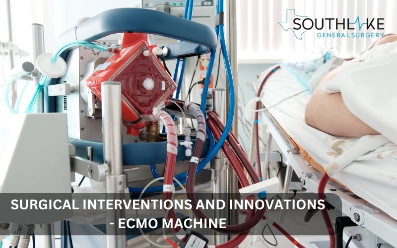 Extracorporeal membrane oxygenation (ECMO) machine used for temporary support in severe cases of diaphragmatic hernia, aiding in heart and lung function.