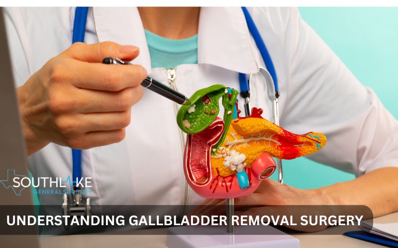 Medical illustration showing the location of the gallbladder and surrounding organs.