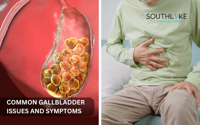 Illustration of gallstones in the gallbladder and symptoms such as pain in the abdomen.