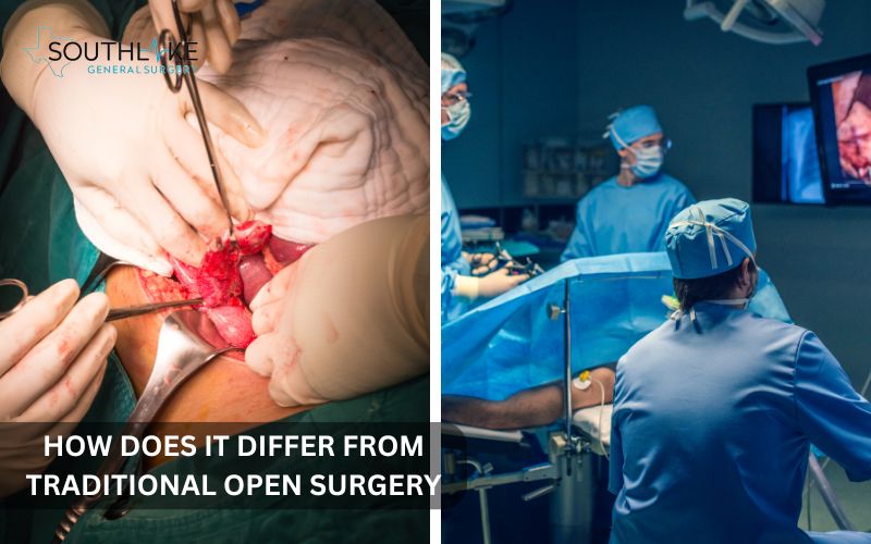 Comparison between open surgery and laparoscopic surgery showing incision sizes.