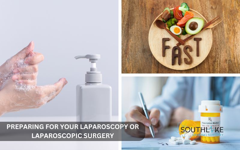 Checklist for laparoscopic surgery preparation, including fasting, medication management, and hygiene instructions.