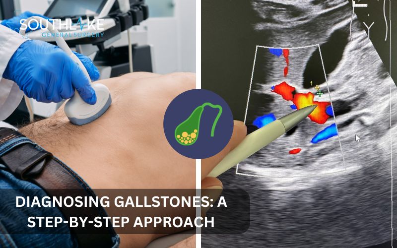 Medical tests for gallstones, showing an ultrasound scan and an ERCP procedure with the bile ducts.