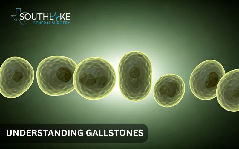 Different types of gallstones on display.