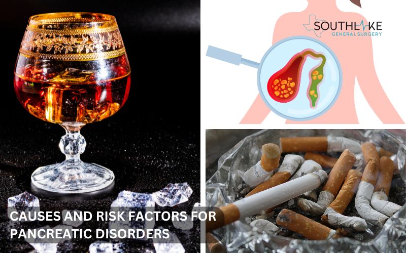 Image is displaying causes of pancreas problems such as gallstones, alcohol consumption, and smoking.