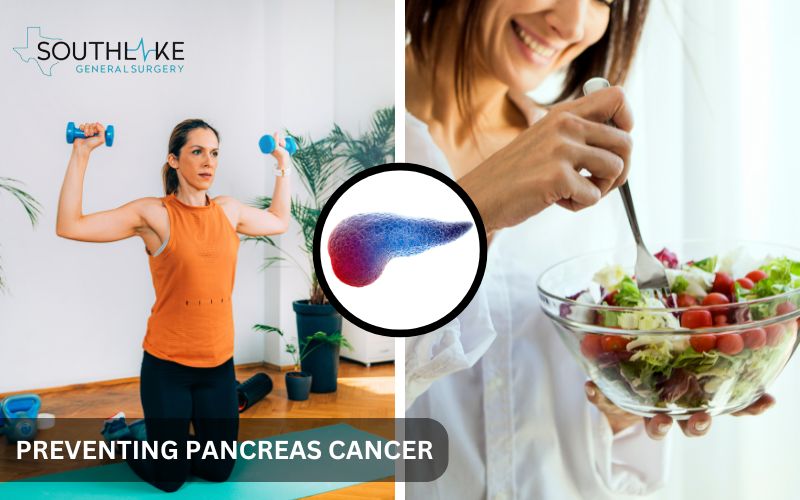 Image on lifestyle changes to reduce the risk of pancreatic cancer, including healthy eating and regular exercise.