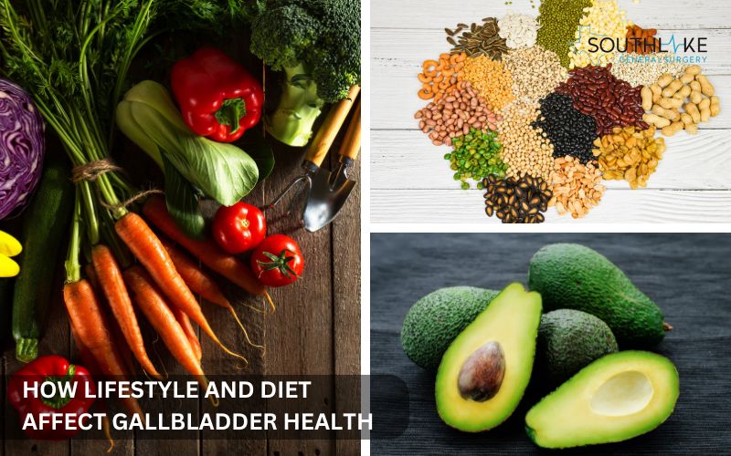 Healthy food options like vegetables, whole grains, and avocados for gallbladder health.