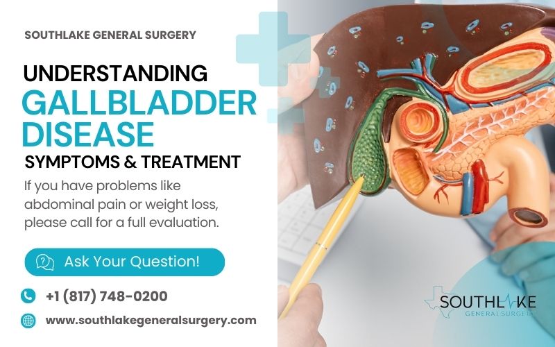 " Illustration of the gallbladder's location in the human body, showing its connection to the liver and bile ducts.