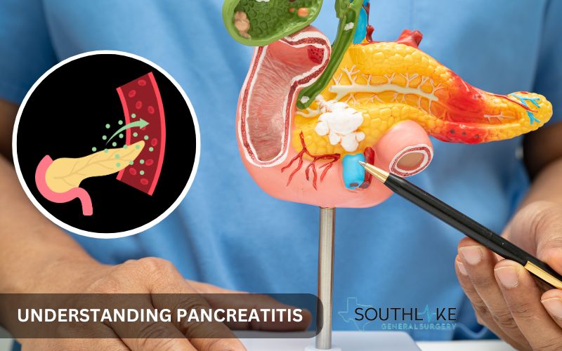 Image explaining the function of the pancreas and how inflammation affects digestion and blood sugar control.