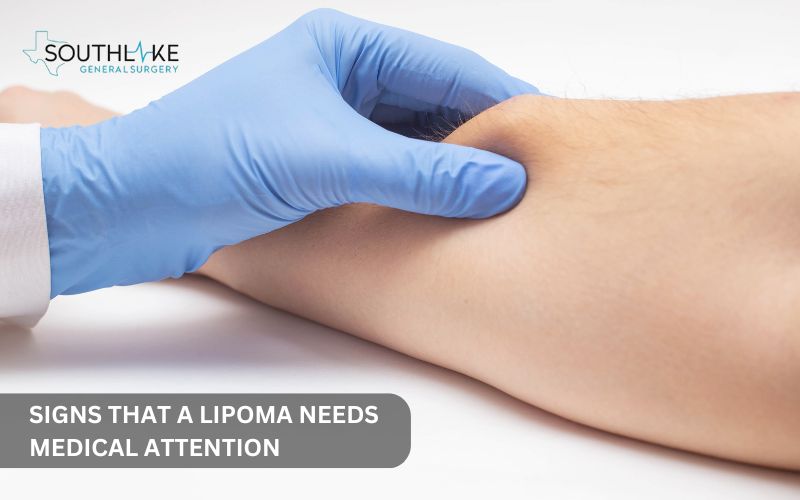 A person pressing on a lipoma on their arm, checking for pain and growth.