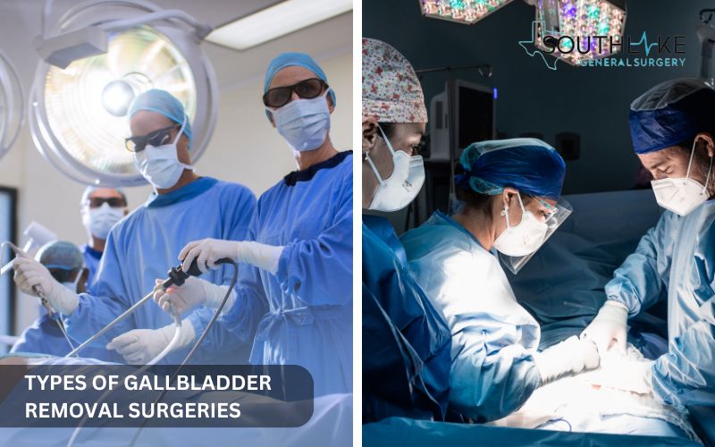 Comparison of laparoscopic and open gallbladder removal surgery, showing incision sites and surgical tools.