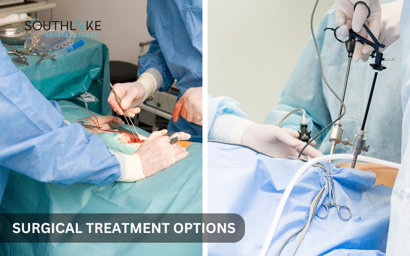 Surgical options for incisional hernia repair: open surgery vs. laparoscopic procedure.