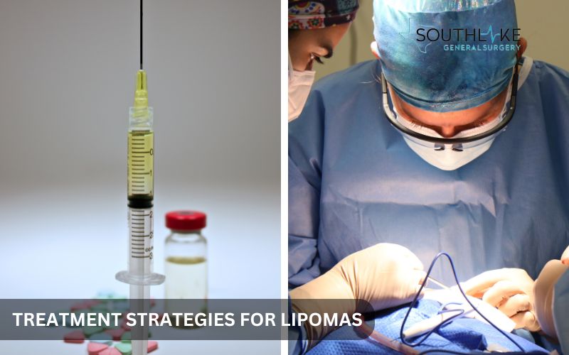 Comparison chart showing surgical and non-surgical treatments for lipomas, including steroid injections and excision surgery.