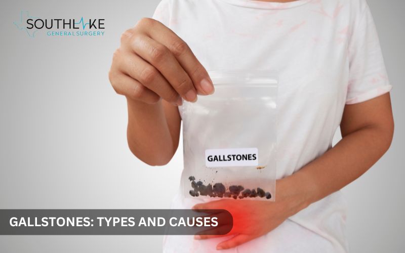 A medical image displaying cholesterol and pigment gallstones of different sizes and colors.