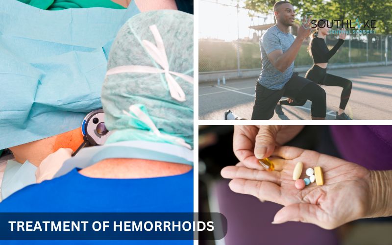 Comparison table of non-surgical and surgical treatment options for hemorrhoids, including lifestyle changes, medications, and procedures.