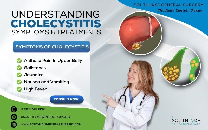 Illustration of an inflamed gallbladder with gallstones causing cholecystitis.