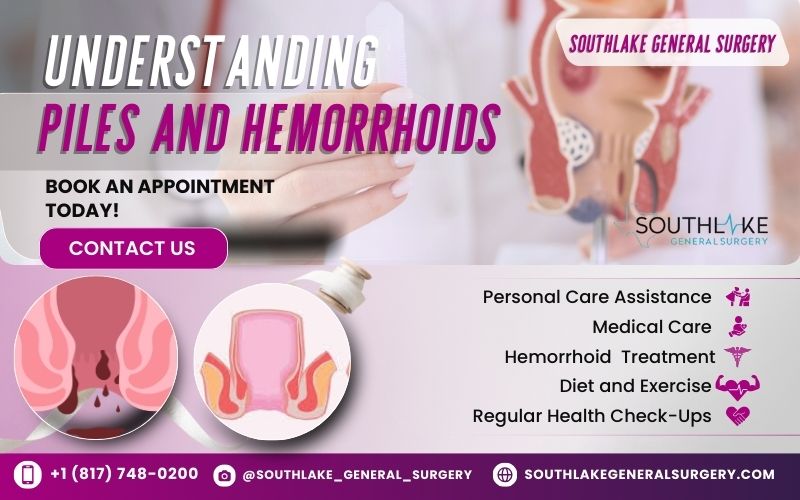 Medical illustration showing the difference between normal veins and swollen hemorrhoidal veins in the rectal area.